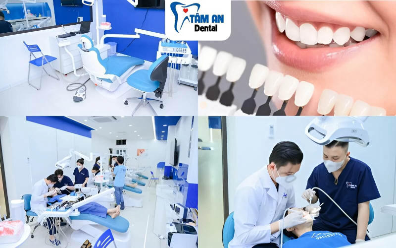 Nha Khoa Tâm An là địa chỉ bọc răng sứ uy tín, chất lượng cao với giá thành hợp lý