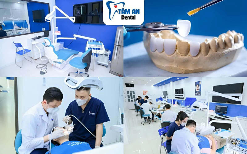 Nha Khoa Tâm An - Địa chỉ bọc răng sứ Titan an toàn, bền đẹp, giá tốt