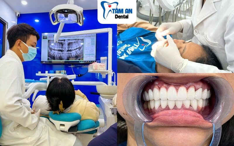 Nha khoa Tâm An là địa chỉ phục hình thẩm mỹ uy tín hàng đầu tại TPHCM