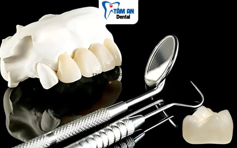 Răng toàn sứ Bio Esthetic mới ra mắt trên thị trường không lâu nên chưa phổ biến rộng rãi