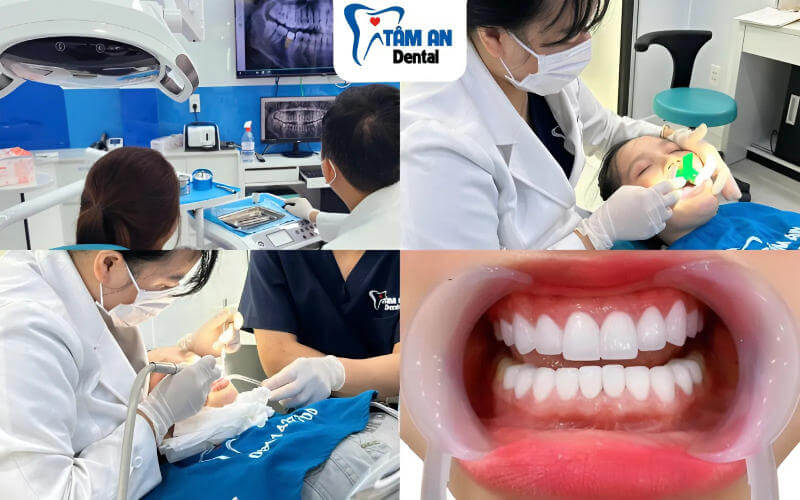 Quy trình bọc răng sứ Orodent tại Nha Khoa Tâm An theo đúng quy chuẩn của Bộ Y tế