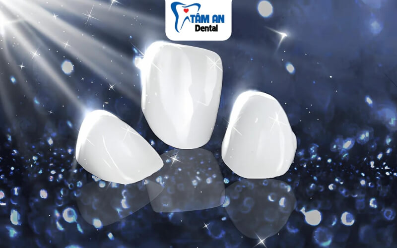 Răng sứ Diamond có màu sắc trắng sáng tự nhiên, thấu quang tốt và độ bền cao