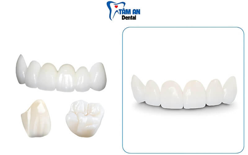 Răng sứ Zirconia có 2 loại chính là răng sứ Zirconia dạng rắn và răng sứ Zirconia dạng lớp