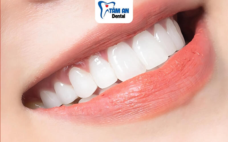 Răng sứ Zirconia có ưu điểm về độ bền cao, thẩm mỹ vượt trội, an toàn cho sức khỏe